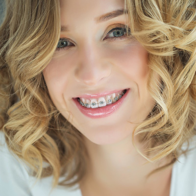 A woman with braces is smiling at the camera, wearing a white top and her hair is styled in loose waves.